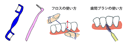 歯磨きと歯間清掃 健康ひょうご21県民運動ポータルサイト